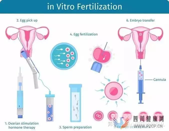做一个试管婴儿要花多少钱医保能报销吗(2022年试管婴儿费用医保可以报销吗)(图3) 做一个试管婴儿要花多少钱医保能报销吗(2022年试管婴儿费用医保可以报销吗)(图3)