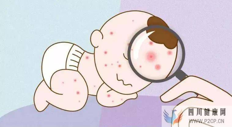 过敏不可小觑,您的孩子过敏吗?(图1) 过敏不可小觑,您的孩子过敏吗?(图1)