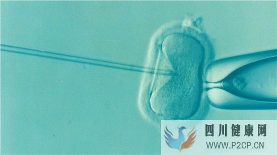 试管婴儿的成功率有多高呢(第二代试管婴儿成功率有多少)(图1) 试管婴儿的成功率有多高呢(第二代试管婴儿成功率有多少)(图1)