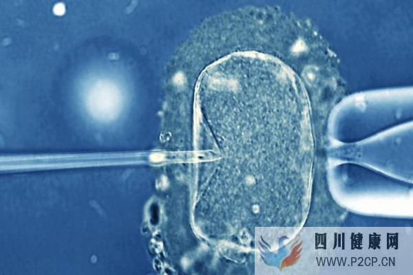 影响美国试管婴儿的主导因素男性还是女性?(男性试管婴儿怎么做的全过程)(图1) 影响美国试管婴儿的主导因素男性还是女性?(男性试管婴儿怎么做的全过程)(图1)