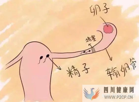 输卵管不孕做试管婴儿手术过程中,常见的六个问题(女方输卵管堵塞做试管婴儿需要多长时间)(图2) 输卵管不孕做试管婴儿手术过程中,常见的六个问题(女方输卵管堵塞做试管婴儿需要多长时间)(图2)