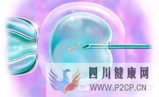 很多人说试管婴儿可能不会是自己亲生的,这是真的...(试管婴儿90%不是自己的)(图3) 很多人说试管婴儿可能不会是自己亲生的,这是真的...(试管婴儿90%不是自己的)(图3)