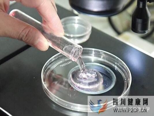 试管婴儿是自己亲生的吗看完你就懂了!(试管婴儿90%不是自己的)(图4) 试管婴儿是自己亲生的吗看完你就懂了!(试管婴儿90%不是自己的)(图4)