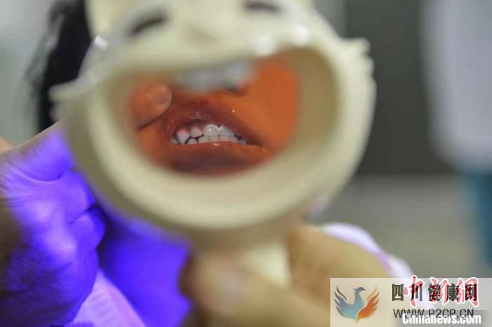 世界口腔健康日:口腔护理从宝宝开始(图1) 世界口腔健康日:口腔护理从宝宝开始(图1)