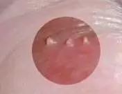 男科常见的几种检查项目,绝对认真!!!(图10) 男科常见的几种检查项目,绝对认真!!!(图10)