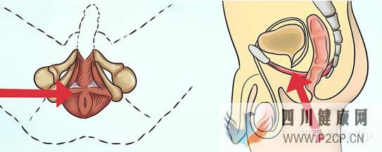 男性PC肌锻炼,凯格尔运动男性版详解(图3) 男性PC肌锻炼,凯格尔运动男性版详解(图3)
