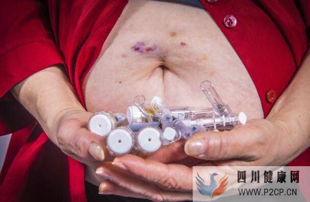 得了糖尿病,若出现这4个症状,你或已并发糖尿病肾病,需重视(图1) 得了糖尿病,若出现这4个症状,你或已并发糖尿病肾病,需重视(图1)