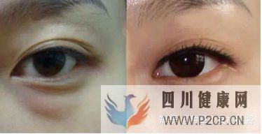 权威解析打干细胞美容的好处和坏处、打了干细胞脸...(干细胞对面部的重要作用)(图8) 权威解析打干细胞美容的好处和坏处、打了干细胞脸...(干细胞对面部的重要作用)(图8)