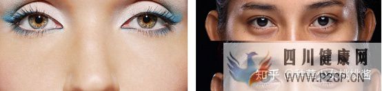 权威解析打干细胞美容的好处和坏处、打了干细胞脸...(干细胞对面部的重要作用)(图11) 权威解析打干细胞美容的好处和坏处、打了干细胞脸...(干细胞对面部的重要作用)(图11)