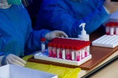 周二测男性周四测女性,大连核酸检测“男女分采”有何好处?(图1) 周二测男性周四测女性,大连核酸检测“男女分采”有何好处?(图1)