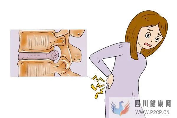 引起腰椎间盘突出的原因是什么(图1) 引起腰椎间盘突出的原因是什么(图1)