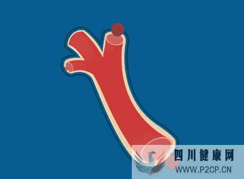 冬季做好这些事,不给心血管“添堵”,专家解读心血管的早期预防(图1) 冬季做好这些事,不给心血管“添堵”,专家解读心血管的早期预防(图1)