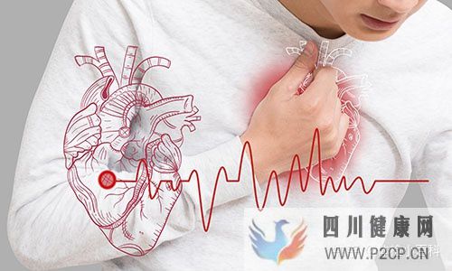 心血管疾病的4个症状常被忽视(图1) 心血管疾病的4个症状常被忽视(图1)