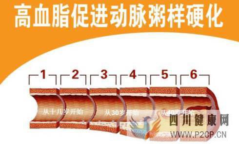 糖尿病血脂异常的5大症状表现!(图2) 糖尿病血脂异常的5大症状表现!(图2)