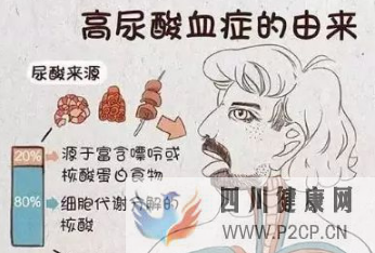 高尿酸的症状有哪些,治疗尿酸高的方法(图1) 高尿酸的症状有哪些,治疗尿酸高的方法(图1)