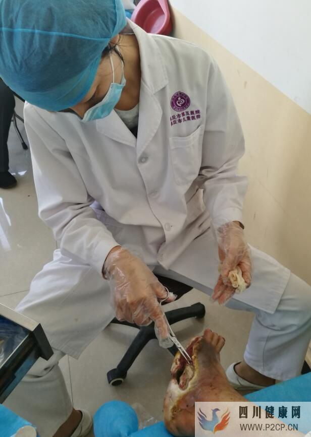 糖尿病患者出现哪些症状,需警惕神经病变的发生?(图1) 糖尿病患者出现哪些症状,需警惕神经病变的发生?(图1)