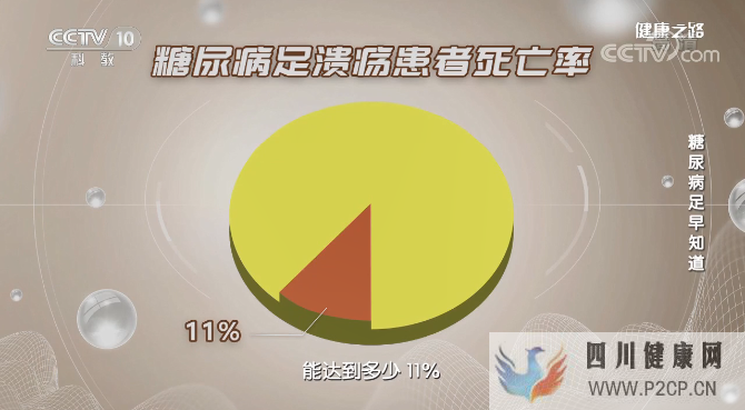 最新研究!干细胞疗法有望使糖尿病相关截肢成为过去(图2) 最新研究!干细胞疗法有望使糖尿病相关截肢成为过去(图2)