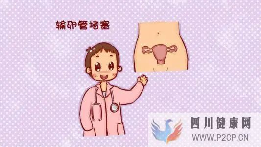 输卵管堵塞也是分类型的(图1)