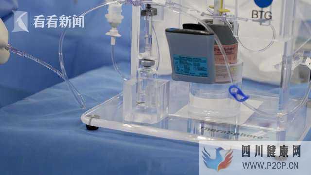 国内首例!钇90玻璃微球临床治疗在海南博鳌成功实施(图2) 国内首例!钇90玻璃微球临床治疗在海南博鳌成功实施(图2)