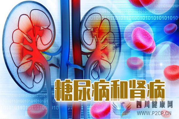 男子空腹血糖正常为何诊断为糖尿病肾病?做好这3件事可预防肾病(图3) 男子空腹血糖正常为何诊断为糖尿病肾病?做好这3件事可预防肾病(图3)