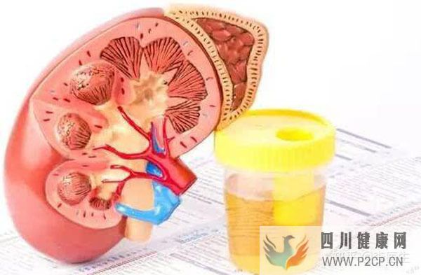 男童吃炸鸡喝饮料发生高尿酸肾病,如何控制高尿酸预防肾损害?(图1) 男童吃炸鸡喝饮料发生高尿酸肾病,如何控制高尿酸预防肾损害?(图1)