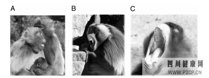 打哈欠为什么会传染(图2) 打哈欠为什么会传染(图2)