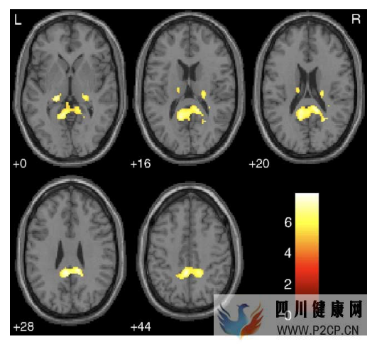 打哈欠为什么会传染(图5) 打哈欠为什么会传染(图5)