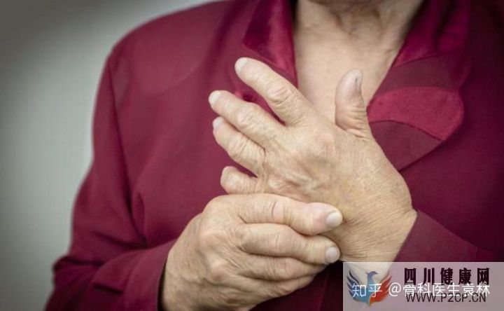 风湿和类风湿性关节炎有什么区别(图1) 风湿和类风湿性关节炎有什么区别(图1)