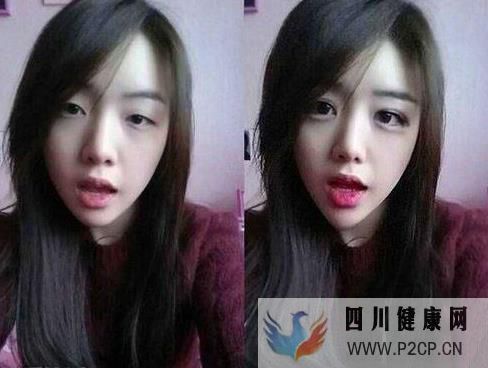 美容整形前一定要知道的美容整形知识(图4)