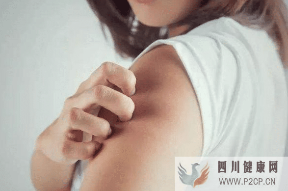 湿疹是怎么引起的?怎么治疗能除根?(图1) 湿疹是怎么引起的?怎么治疗能除根?(图1)