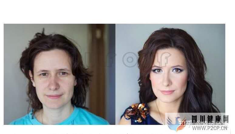 关于干细胞填充要做几次,干细胞填充一般多久才看到...(图7) 关于干细胞填充要做几次,干细胞填充一般多久才看到...(图7)