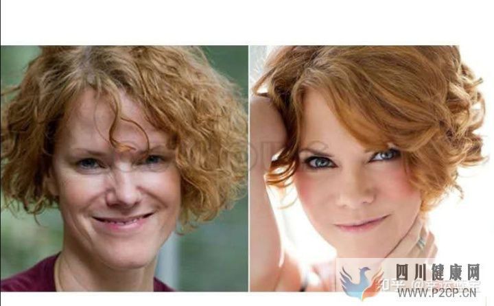 关于干细胞填充要做几次,干细胞填充一般多久才看到...(图9) 关于干细胞填充要做几次,干细胞填充一般多久才看到...(图9)