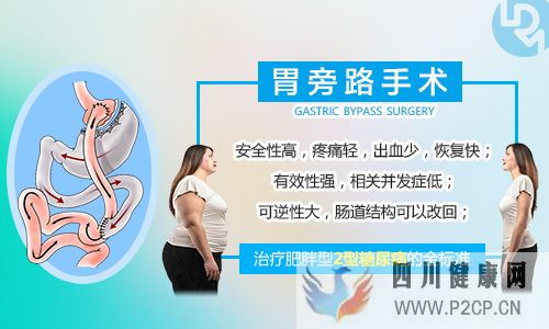 胃旁路手术治疗糖尿病怎么样?(图1) 胃旁路手术治疗糖尿病怎么样?(图1)