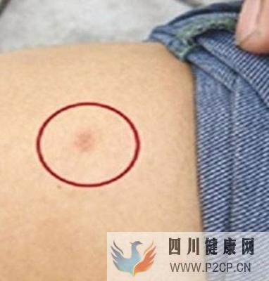 临汾泌尿专科医院:前列腺炎怎么治疗比较好(图1) 临汾泌尿专科医院:前列腺炎怎么治疗比较好(图1)