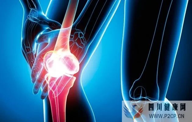 髌骨软化症应该怎么治疗髌骨软化症怎么治疗比较好髌骨软化(图1) 髌骨软化症应该怎么治疗髌骨软化症怎么治疗比较好髌骨软化(图1)