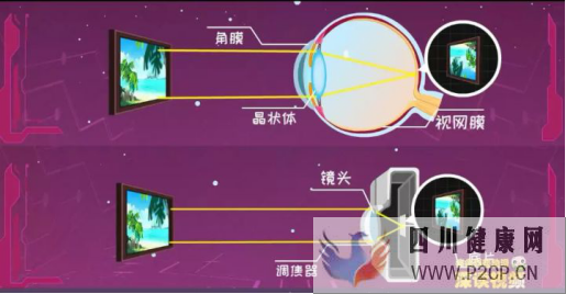 白内障的病因是什么?(图1) 白内障的病因是什么?(图1)