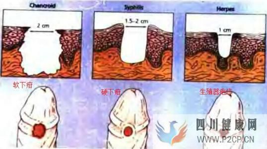 临汾泌尿专科医院:患有前列腺炎有哪些东西是不应该吃的呢(图1) 临汾泌尿专科医院:患有前列腺炎有哪些东西是不应该吃的呢(图1)