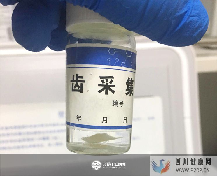 牙髓干细胞采集方法是什么,去哪里储存?(图1) 牙髓干细胞采集方法是什么,去哪里储存?(图1)