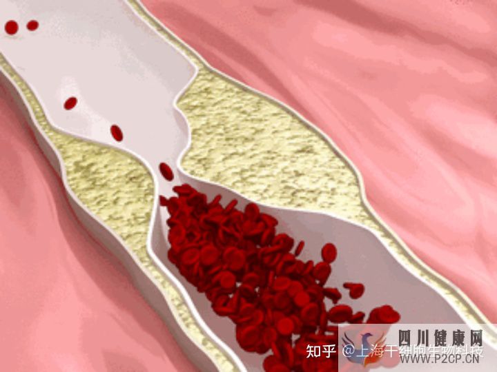 干细胞为什么被称为“全能ACE”,读这篇就够了(图5) 干细胞为什么被称为“全能ACE”,读这篇就够了(图5)