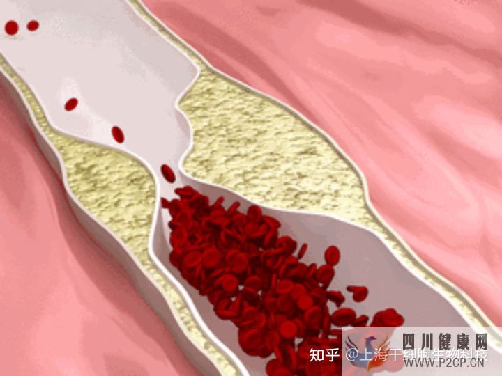 干细胞为什么被称为“全能ACE”,读这篇就够了(图6) 干细胞为什么被称为“全能ACE”,读这篇就够了(图6)