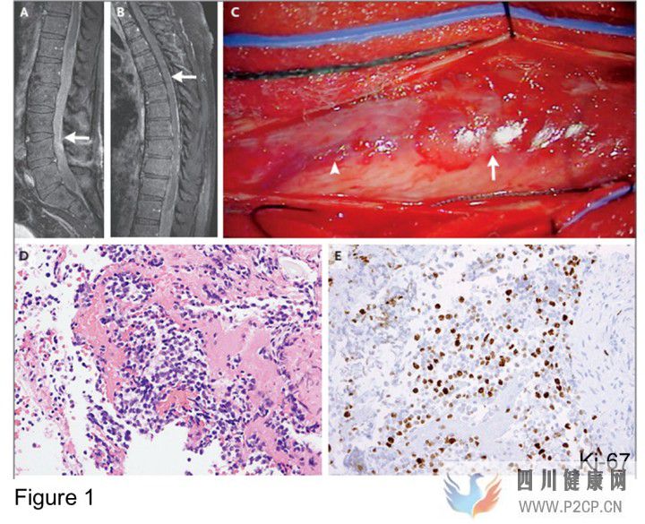 干细胞治疗天使还是恶魔(图3) 干细胞治疗天使还是恶魔(图3)
