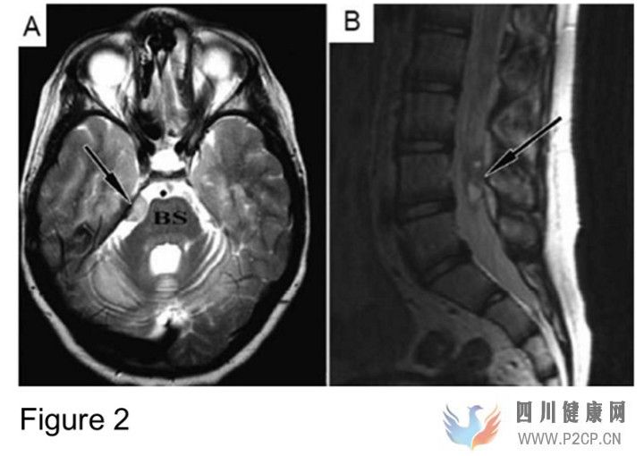 干细胞治疗天使还是恶魔(图5) 干细胞治疗天使还是恶魔(图5)