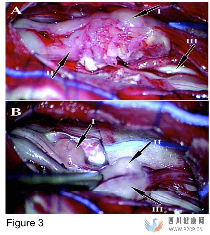 干细胞治疗天使还是恶魔(图7) 干细胞治疗天使还是恶魔(图7)
