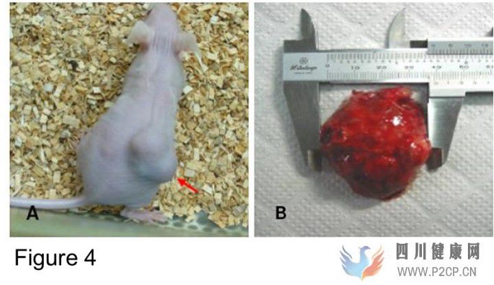 干细胞治疗天使还是恶魔(图9) 干细胞治疗天使还是恶魔(图9)