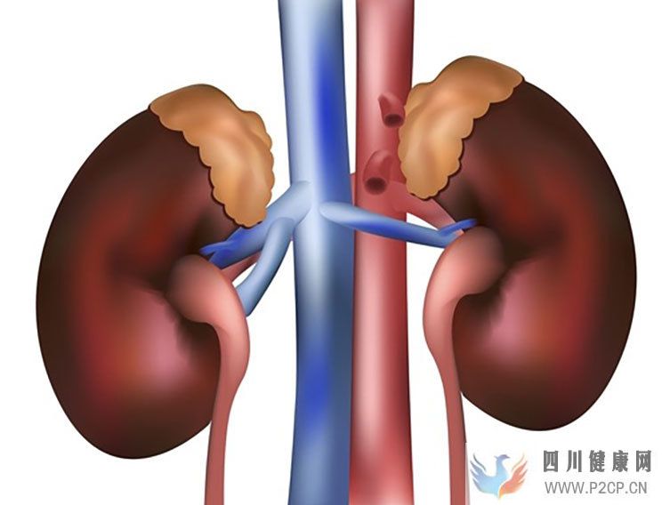 慢性肾脏病肾功能不全的概述及导致问题日本干细胞如何治疗(图1) 慢性肾脏病肾功能不全的概述及导致问题日本干细胞如何治疗(图1)