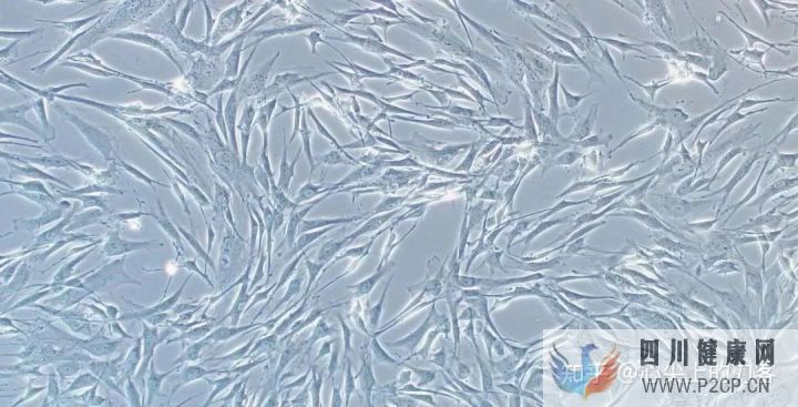 间充质干细胞治疗适应症有哪些(图4) 间充质干细胞治疗适应症有哪些(图4)