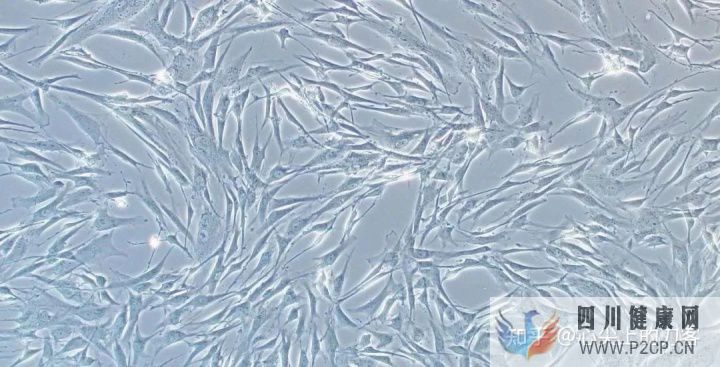 间充质干细胞治疗适应症有哪些(图3) 间充质干细胞治疗适应症有哪些(图3)