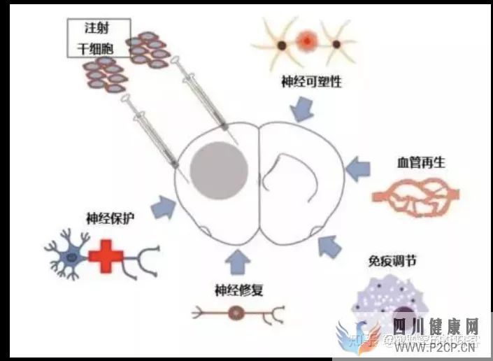 间充质干细胞治疗适应症有哪些(图11) 间充质干细胞治疗适应症有哪些(图11)