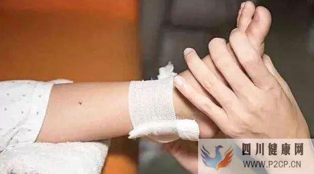 间充质干细胞可以有效治疗糖尿病及糖尿病创伤!(图1) 间充质干细胞可以有效治疗糖尿病及糖尿病创伤!(图1)