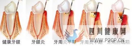 牙髓间充质干细胞填补了干细胞研究的空白(图8) 牙髓间充质干细胞填补了干细胞研究的空白(图8)